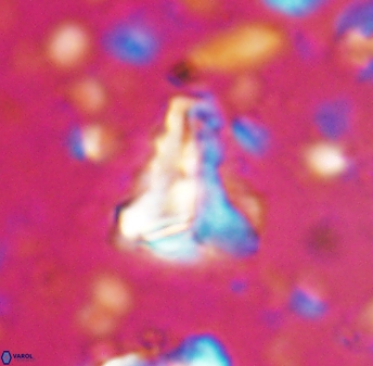 Braarudosphaera sp 1 6830