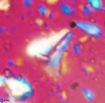 Braarudosphaera sp 1 6833