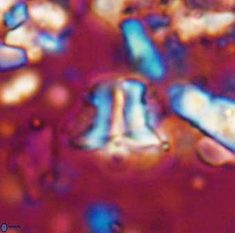 Braarudosphaera sp 2 7568