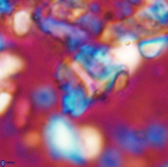 Braarudosphaera sp 2 7569