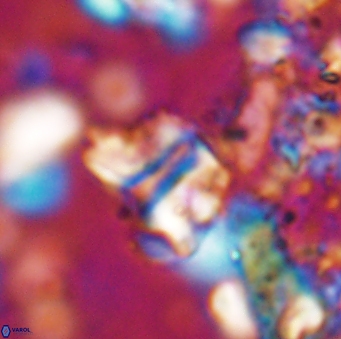 Braarudosphaera sp 2 7571