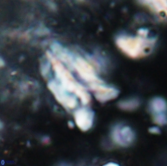 Braarudosphaera sp 4 6687