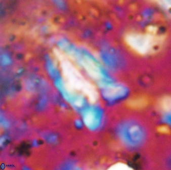 Braarudosphaera sp 4 6688