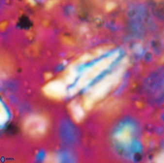 Braarudosphaera sp 4 6692