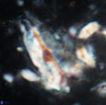 Braarudosphaera sp 5 6724