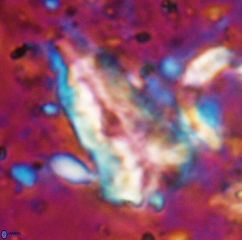 Braarudosphaera sp 5 6725