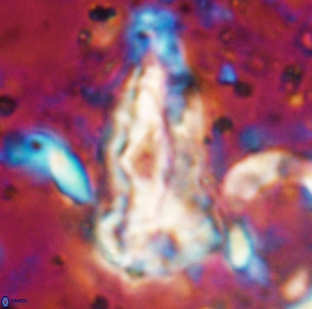 Braarudosphaera sp 5 6726