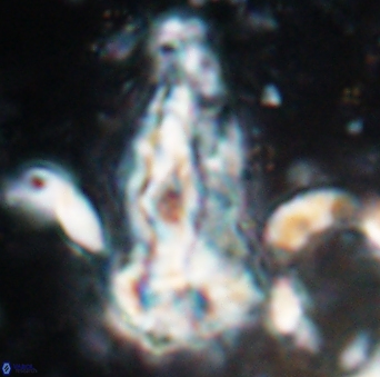 Braarudosphaera sp 5 6727