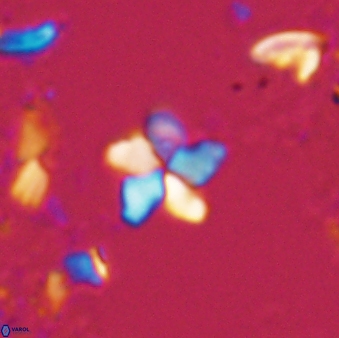 Braarudosphaera stenorhetha 17468