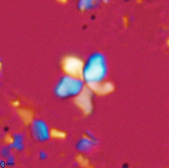 Braarudosphaera stenorhetha 17470