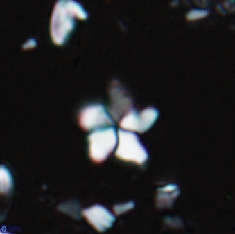 Braarudosphaera stenorhetha 17471