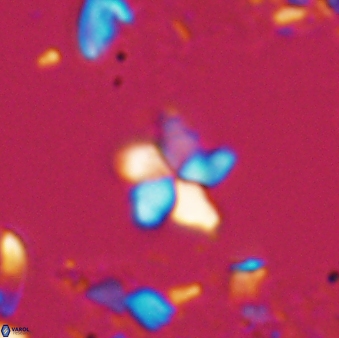 Braarudosphaera stenorhetha 17472