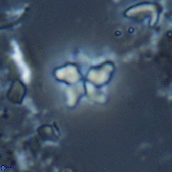 Braarudosphaera stenorhetha 17474