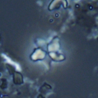 Braarudosphaera stenorhetha 17475