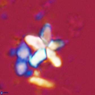 Braarudosphaera stenorhetha 17539