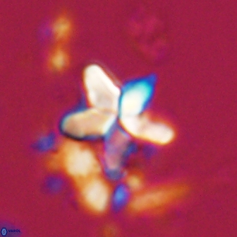 Braarudosphaera stenorhetha 17541