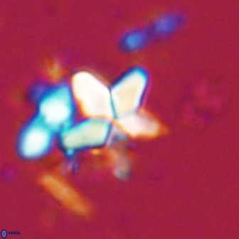 Braarudosphaera stenorhetha 17543