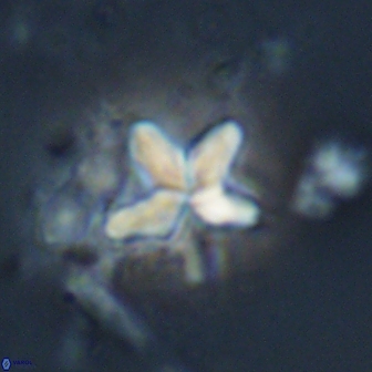 Braarudosphaera stenorhetha 17547