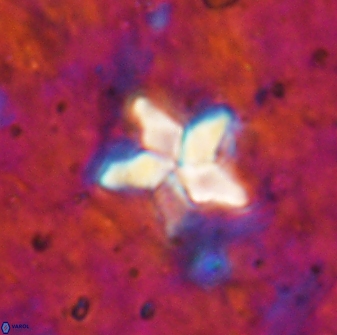 Braarudosphaera stenorhetha 19570