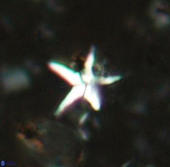 Braarudosphaera stenorhetha 2279