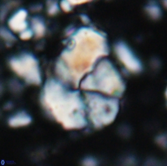 Braarudosphaera pseudobatilliformis 6585
