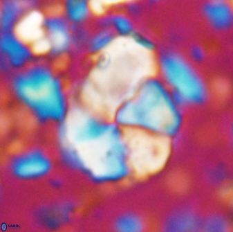 Braarudosphaera pseudobatilliformis 6586