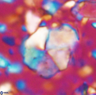 Braarudosphaera pseudobatilliformis 6587