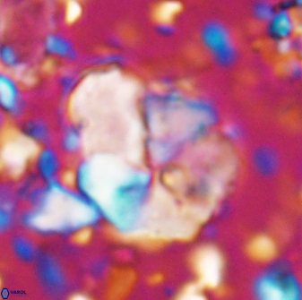 Braarudosphaera pseudobatilliformis 6583