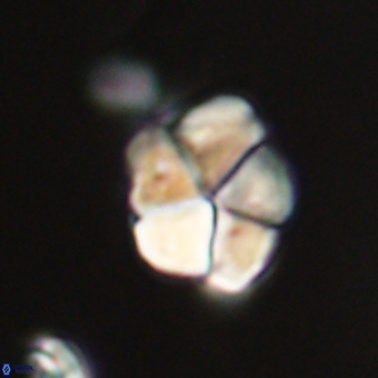 Braarudosphaera pseudobatilliformis 67480