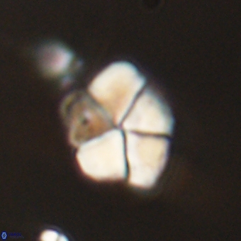 Braarudosphaera pseudobatilliformis 67487