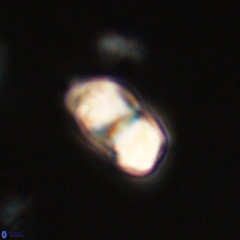 Braarudosphaera pseudobatilliformis 67513