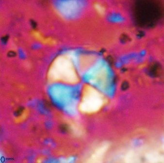 Braarudosphaera psevditurbinea 6694