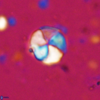 Braarudosphaera psevditurbinea 6733