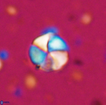 Braarudosphaera psevditurbinea 6734