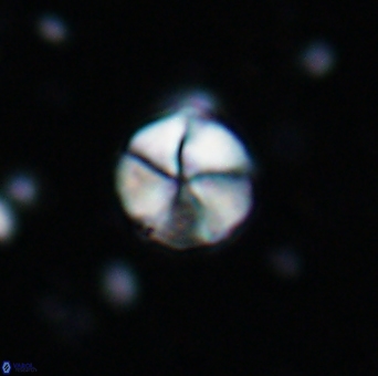 Braarudosphaera psevditurbinea 6735