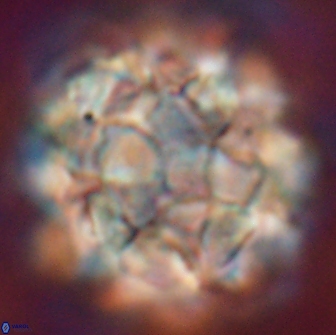 Braarudosphaera regularis 17614