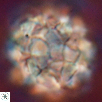 Braarudosphaera regularis 17614