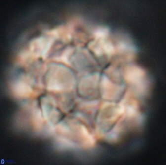 Braarudosphaera regularis 17615