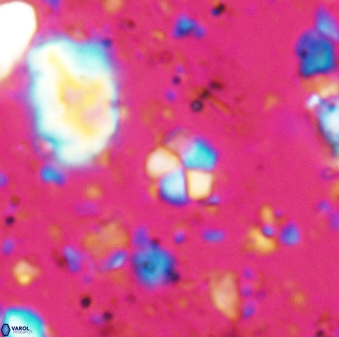 Braarudosphaera wendleriae 7671