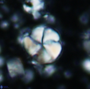 Braarudosphaera psevditurbinea 1016