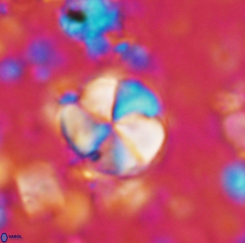 Braarudosphaera psevditurbinea1017