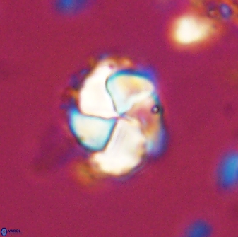 Braarudosphaera turbinea 42585