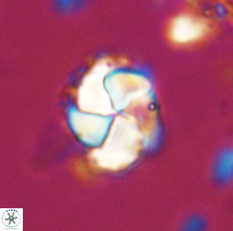 Braarudosphaera turbinea 42585