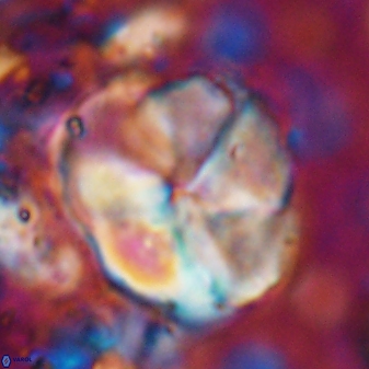 Braarudosphaera turbinea 6521