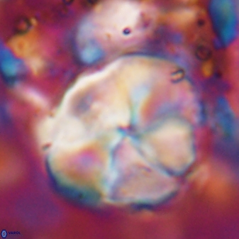 Braarudosphaera turbinea 6524