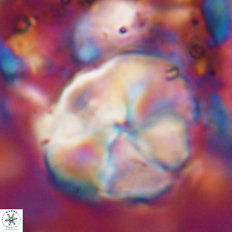 Braarudosphaera turbinea 6524
