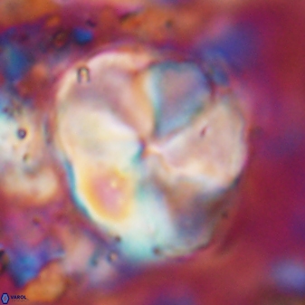 Braarudosphaera turbinea 6525