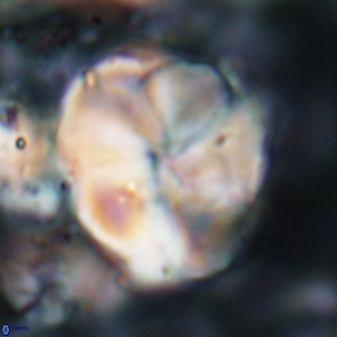 Braarudosphaera turbinea 6526