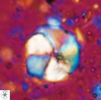 Braarudosphaera turbinea 6696