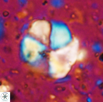 Braarudosphaera turbinea 6697